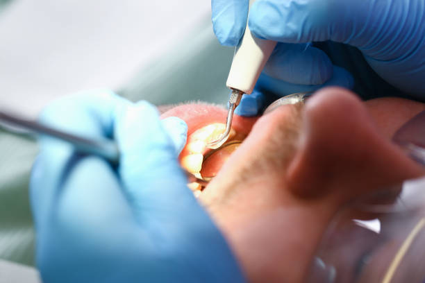 Emergency Dentist for Dental Implants
