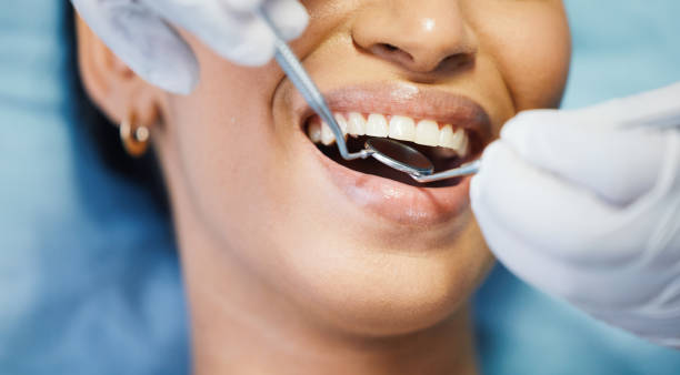 Best Emergency Cosmetic Dentistry in Belmont, CA